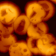 Illustration for article titled These Bruised Blood Cells Are Over 5,000 Years Old